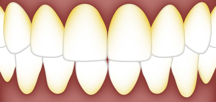 dental-3584756_1280