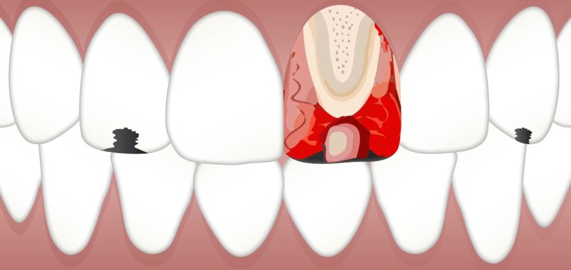 dental-3599745_1280