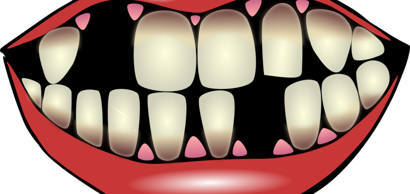 dental-hygiene-156103_1280