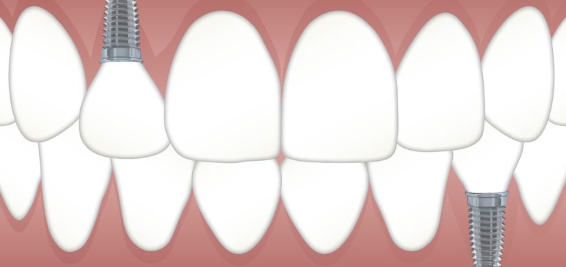 teeth-3597679_1280